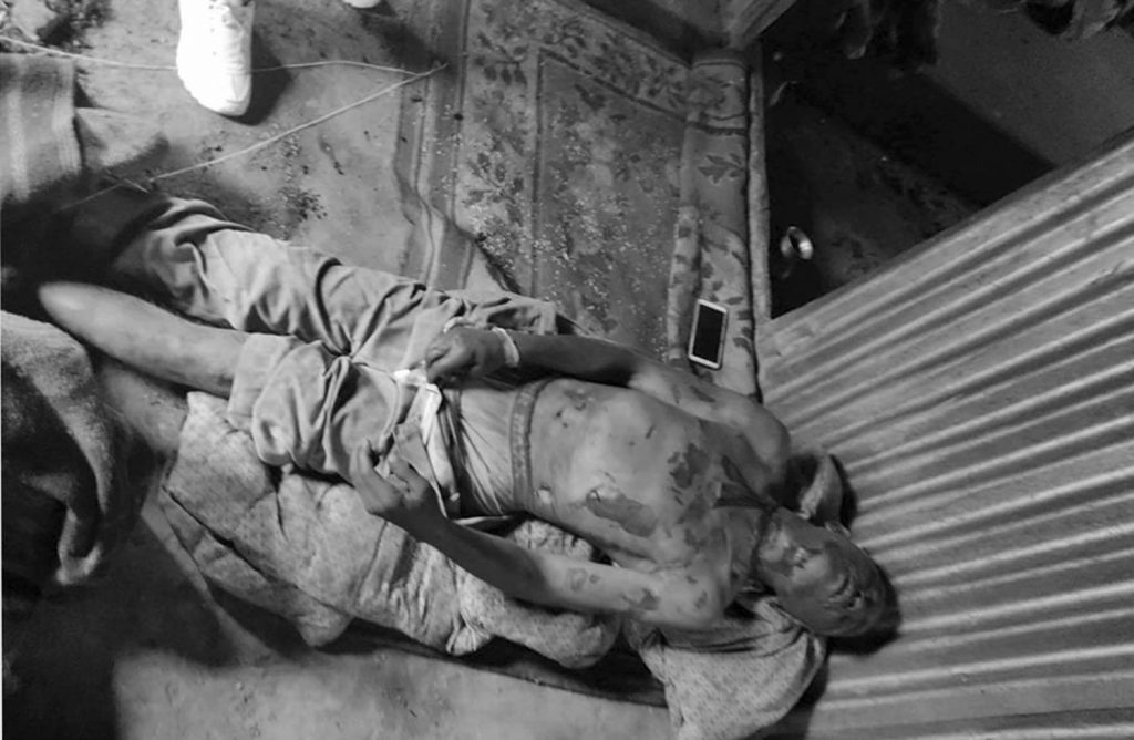 गुल्मीमा झारफुकको क्रममा एकको मृ;त्यु दुइ घाइते